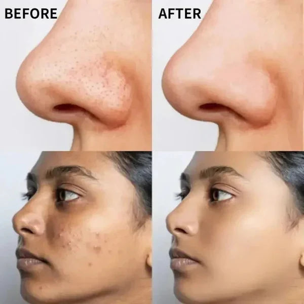 The Ordinary Vitamin C Suspension 30% in Silicone – Brightening Serum (Imported Quality)